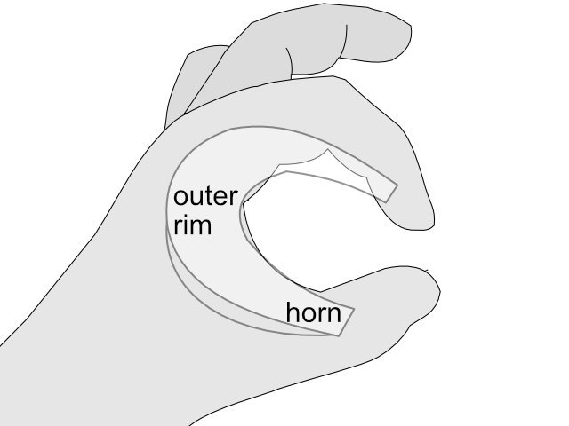 Illustration using the fingertips of thumb and forefinger to illustrate the meniscal horns.