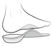 Illustration of a show insert to improve the angulation of the arch of the foot.