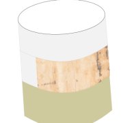 Close-up illustration of the plug of bone and cartilage.