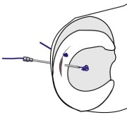 outside-in-mulberry-knot.png