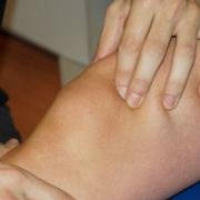 Photograph of the soft tissue area above the patella being pinched to mobilise it.