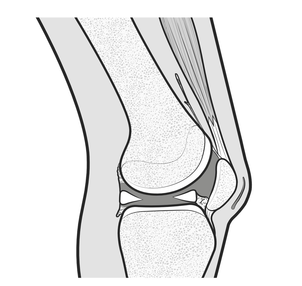 patella-infera-03