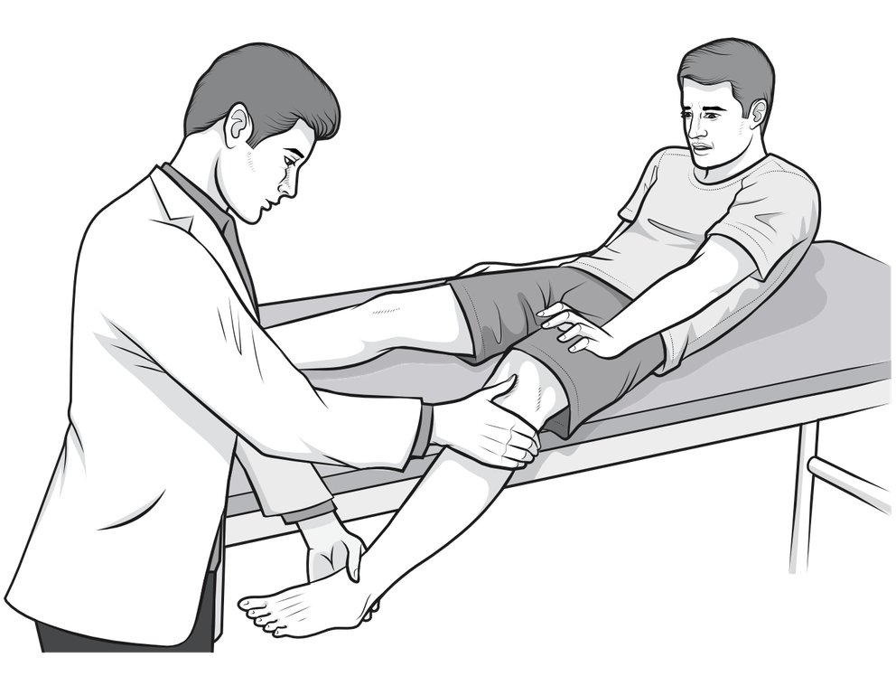 patellar-apprension02