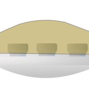 patellar-resurfacing.png