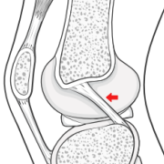 posterior cruciate ligament