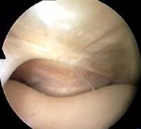 pf_joint05.jpg