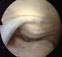 pf_joint06.jpg
