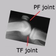 pf_tf_joints.png