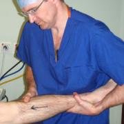 pivot shift test for anterolateral rotatory laxity