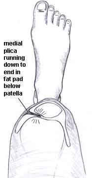 plica03.jpg