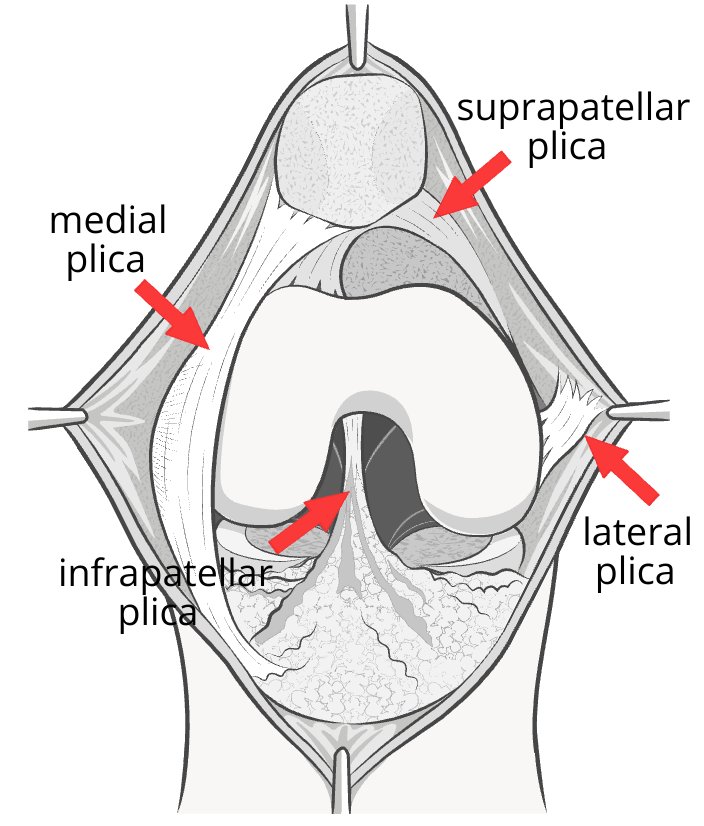 Illustration of the inside of the knee, showing the position of the plicae