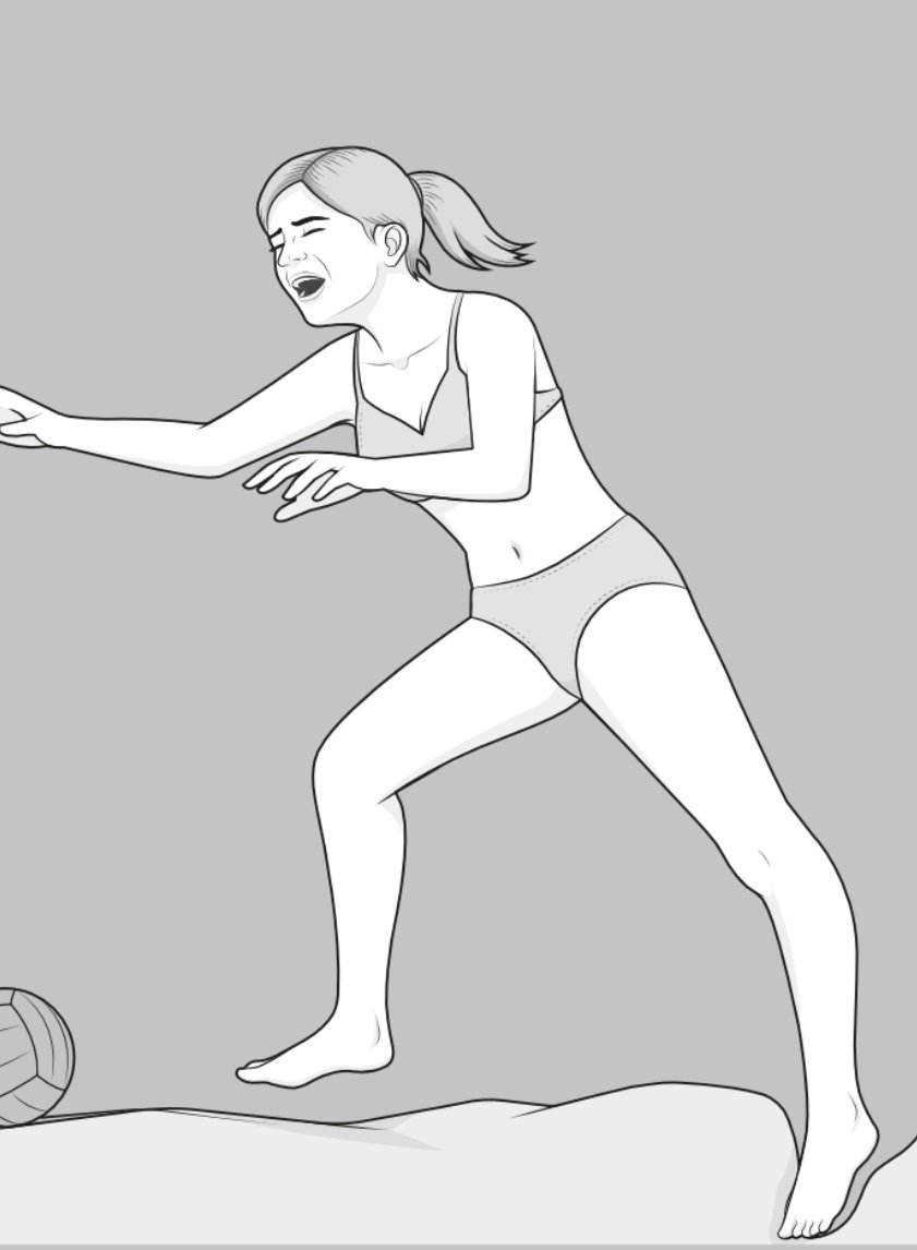 Hyperextension injury to the knee, when the foot is caught in a pothole but the body weight continues to move forward.