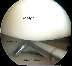 probe05.jpg