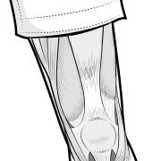 extensor mechanism