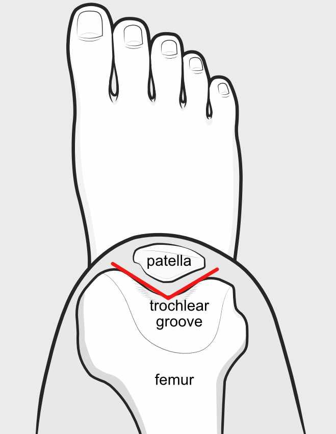 sulcus-angle.jpg
