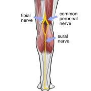 sural_nerve.jpg