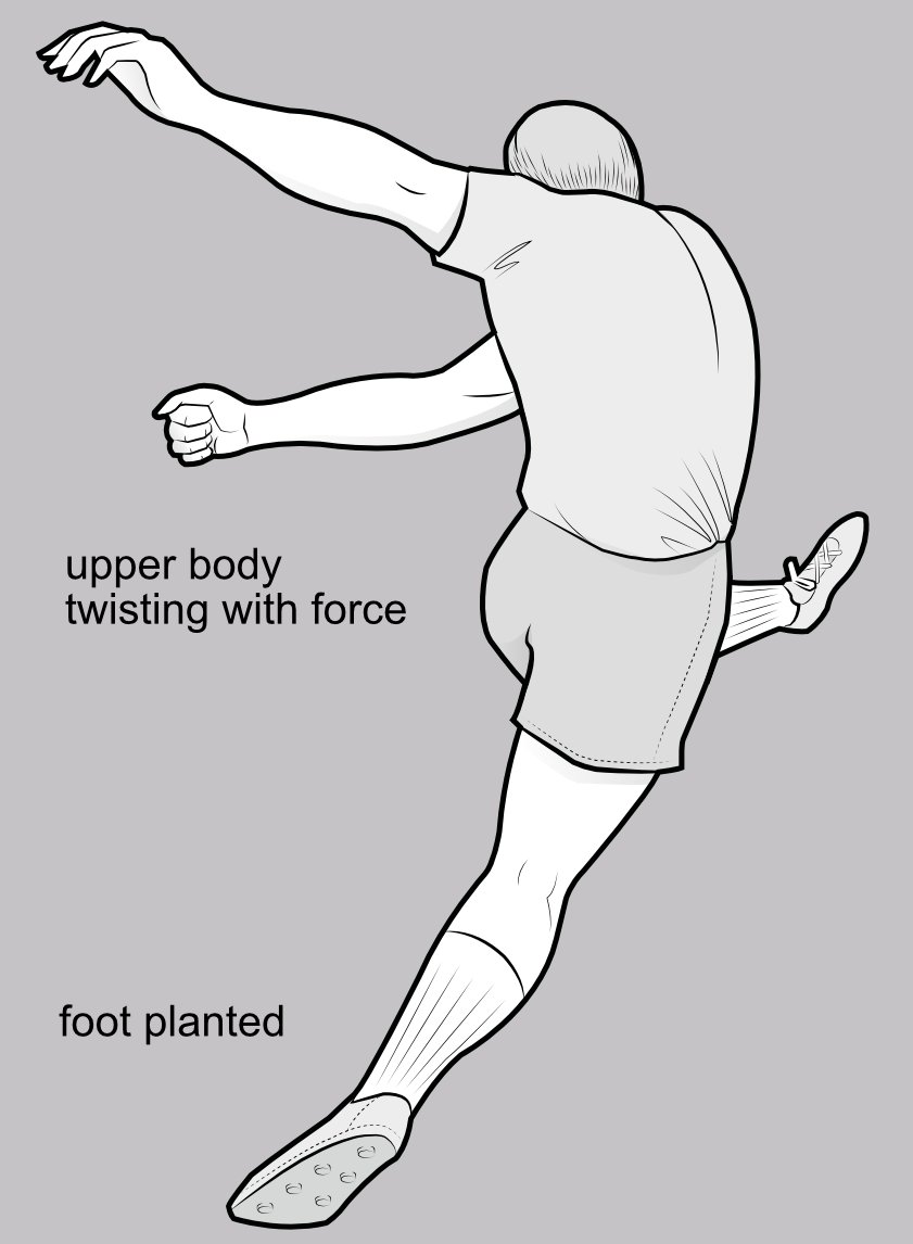 Injury to the knee when the foot is planted but the body continues to twist.