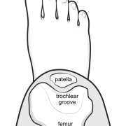 femoral groove or trochlear groove