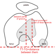 TT-TG distance