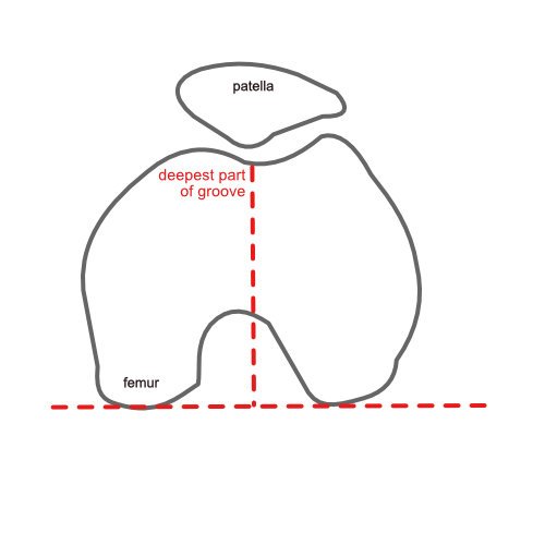 tt-tg_femur_only.jpg