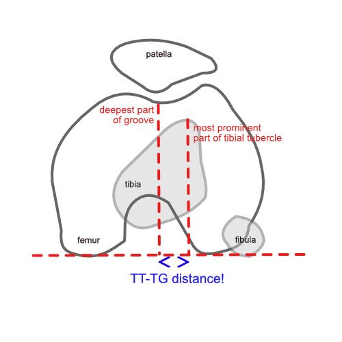 tt-tg_final.jpg
