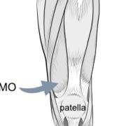VMO - vastus medialis obliquus