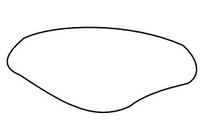 wiberg-type-1.png