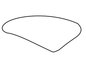 wiberg-type-2.png