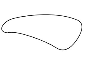 wiberg-type-3.png