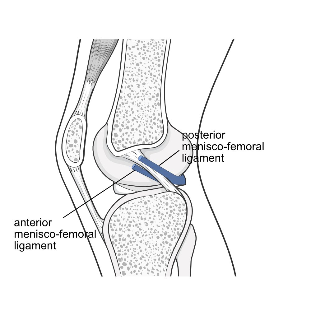 Illustration of anterior and posterior meniscofemoral ligaments